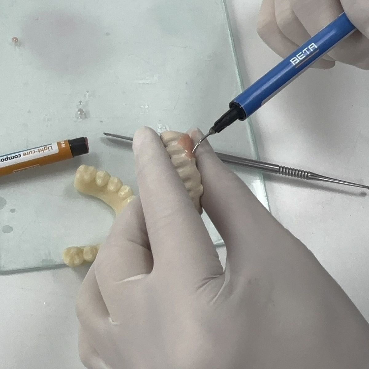 Matériaux dentaires, pont en p - Uv Resin avis et prix